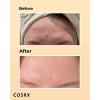 imageCOSRX Post Acne Mark Recovery  Snail Mucin 96 Essence  Vitamin C 13 Serum Intensive Hydrating for Fine lines Hyperpigmentation After Blemish Care