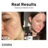 imageCOSRX Post Acne Mark Recovery Acne Pimple Master Pach 96 counts  Niacinamide 15 Serum Spot Treatment Patches and Niacinamide Essence for Blemish ampamp Discoloration Treatment Korean Skincare